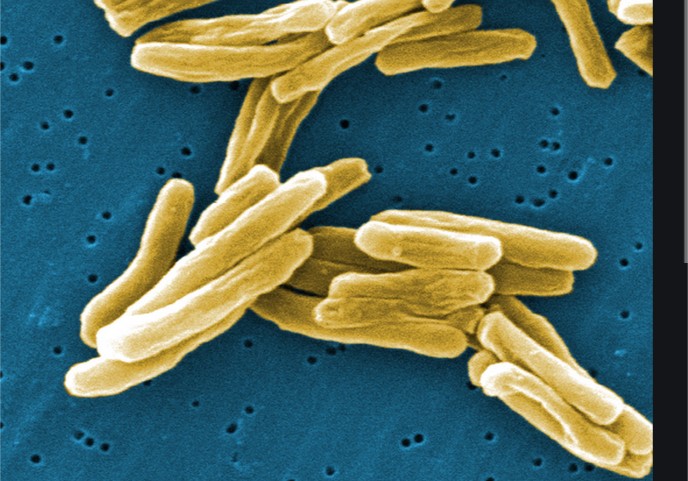 Mycobacterium tuberculosis   PHOTO
