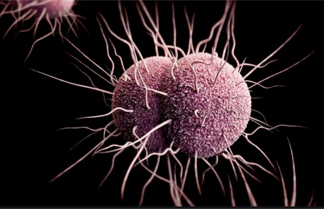 Neisseria gonorrhoeae   PHOTO
