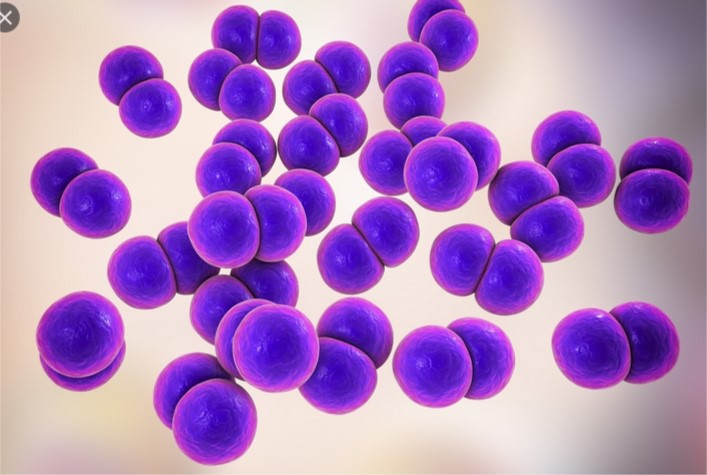 Streptococcus pneumoniae   PHOTO