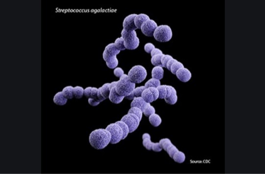 Streptococcus agalactiae   PHOTO